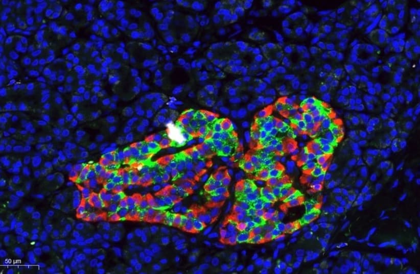 Neue DNA-Methode zur präzisen Analyse von Bauchspeicheldrüsenzellen
