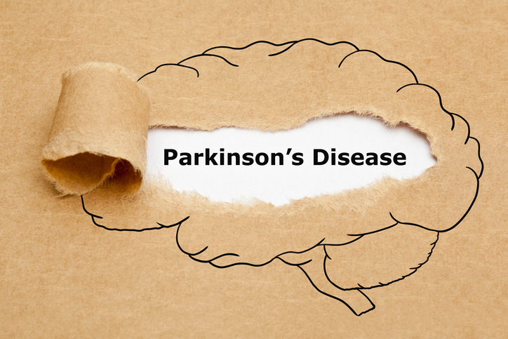 Jahrzehnte früher: Neue Methode zur Parkinson-Frühdiagnose